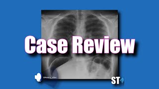 Case Review  Pneumoperitoneum [upl. by Deanna]