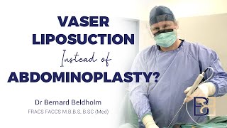 VASER Liposuction instead of Abdominoplasty [upl. by Rock]