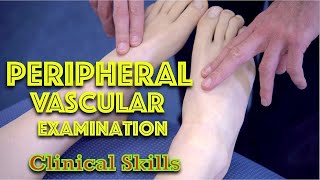 Peripheral Vascular Examination  Clinical Skills  Dr Gill [upl. by Nodnil]