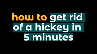 TIPS how to get rid of a hickey in 5 minutes [upl. by Tran825]