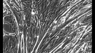 C2C12 muscle cell contractions Part II [upl. by Feinberg]