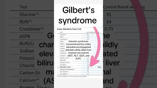 Gilbert’s syndrome impacts about 10 of the population gilbertssyndrome liverdisease nutrition [upl. by Haimrej]