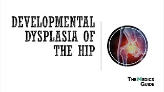 Developmental Dysplasia Of The Hip  A Clinical Overview for Medical Students [upl. by Notyrb]