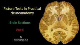 Picture Test in Neuroanatomy Brain Sections 5 [upl. by Reivaxe]