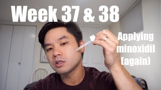 Week 37 amp 38  Minoxidil Beard Journey how I apply minoxidil [upl. by Eenram377]