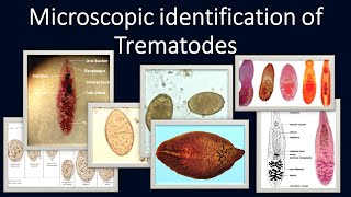 Microscopic identification of Trematodes [upl. by Zaid620]