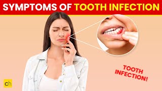 10 Symptoms of a Tooth Infection You Shouldnt Ignore  Credihealth toothpainrelief tooth [upl. by Meil275]