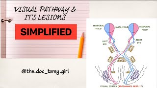 THE VISUAL PATHWAY amp Its Lesions  Physiology Ophthalmology [upl. by Afirahs]