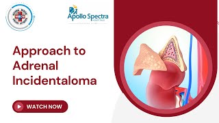 Approach to Adrenal Incidentaloma [upl. by Yahsel]