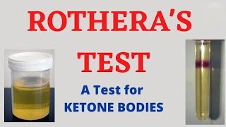 Rotheras Test For Ketone in hindi [upl. by Lenrad276]