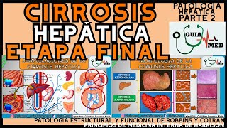 CIRROSIS HEPÁTICA ETAPA FINAL  GuiaMed [upl. by Ahcsatan]