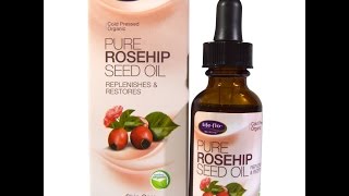 Skin Care hacks  Pure Rosehip Seed Oil [upl. by Ader73]