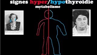 🔴 Dr Astuce  HYPERHYPOTHYROIDIES EXPLIQUÉES CLAIREMENT [upl. by Lamoree844]