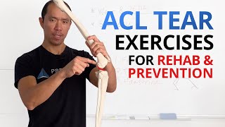 5 Keys amp Exercises to PreventRehab an ACL Tear or Prep for Surgery [upl. by Annice]