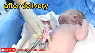 Newborn baby care after leaving the moms womb 😍 afterbirth babyborn [upl. by Shewchuk613]