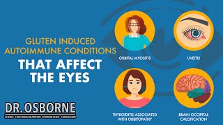 Gluten induced autoimmune diseases that affect the eyes [upl. by Traver]