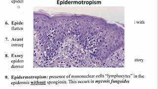 Histopathology 4 👉 Spongiosis amp Epidermotropism [upl. by Norita564]