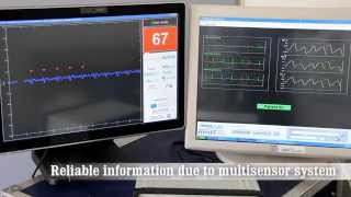 Unobtrusive heart rate monitoring in a bed [upl. by Ainoloppa]