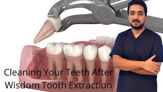 Cleaning Your Teeth After Wisdom Tooth Extraction [upl. by Nalon]