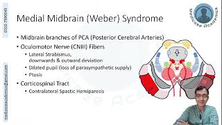 Midbrain Lesions [upl. by Niloc241]