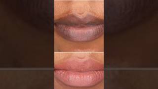 Home Remedy For Darklips darklips drylips homemade remedy viralshort diy beautyguider2395 [upl. by Uon]