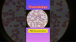 PBS Examination  Hematology  Blood Test  hematology blood shortsvideo [upl. by Aevin]