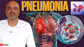 PNEUMONIA o que é Como é o começo da pneumonia O que leva uma pessoa a ter pneumonia [upl. by Orlov293]