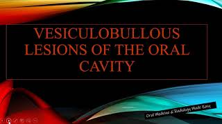 Vesiculobullous lesions of the oral cavity Introduction amp Classification [upl. by Windy]