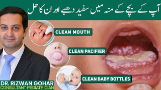 The secret to treating oral thrush 👅in babies oral thrush treatment [upl. by Novj650]