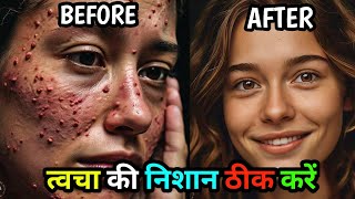 त्वचा की निशान ठीक करें  Home remedy for Skin rashes and itching skinrashes [upl. by Carli935]