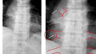 Dossier PAE  Rhumatologie 02 [upl. by Eidualc]