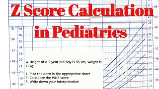 Z Score Calculation । Pediatrics OSPE [upl. by Reeves]