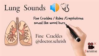 Fine Crackles  Fine Crepitations  Fine Rales  Lung sounds [upl. by Amo]