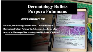 Dermatology Bullets Purpura Fulminans [upl. by Nomyar204]