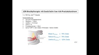 LDRBrachytherapie mit Seeds beim Prostatakarzinom  Strahlentherapie Prof Hilke Vorwerk [upl. by Reham]