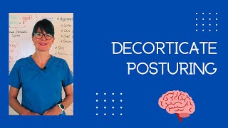 Decorticate Posturing shorts [upl. by Willy]