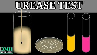 Urease Test [upl. by Rozele]