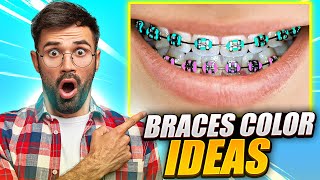 What Are The Best Braces Colors Braces Color Ideas [upl. by Gazzo877]