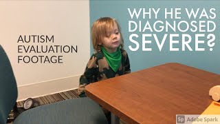 AUTISM EVALUATION FOOTAGE  Diagnosed With Level 3 Severe Autism  WHY They Diagnosed Him Level 3 [upl. by Retse]