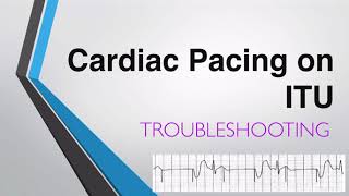 Troubleshooting Transvenous Pacing  Cardiac Pacing on ITU [upl. by Georgeanne]