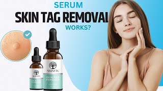 Serum Skin Tag Removal  Skinfix Skin Tag Remover [upl. by Newol]