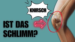 Knirschen im Knie Solltest du dir Sorgen machen [upl. by Kira]