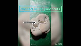 Class1 cavity preparation on plaster model  Preclinical conservative dentistry and endodontics 2yr [upl. by Nyliak]