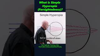 What is simple Hyperopia Farsightedness [upl. by Frederique]