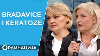 BRADAVICE I KERATOZE  Dr Svetlana Bogdanović i Dr Slavica Peković [upl. by Aerda]