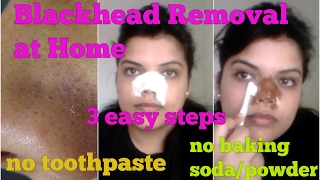 How to REMOVE BLACKHEAD on NOSE at HOME 3 STEPS NATURAL EXTRACTION on FACE MASK 100 result HINDI [upl. by Oluas]