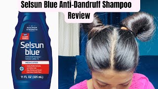 Selsun Blue AntiDandruff Shampoo Reviews Effective or Not [upl. by Ivanah627]