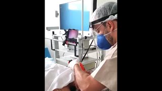 3D printed video laryngoscope intubation AirAngel Blade  Android smartphone Brazil [upl. by Rotman799]