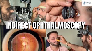 Indirect Ophthalmoscopy [upl. by Fitzsimmons]