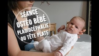 Séance ostéo bébé  plagiocéphalie ou tête plate [upl. by Akemyt]